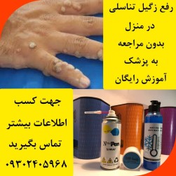 رفع زگیل تناسلی در منزل با کمترین هزینه (کرایوتراپی)