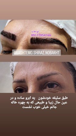 کاشت ابرو فوق  تخصصی در شیراز با ضمانت نامه