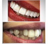 Dental services at the most reasonable prices